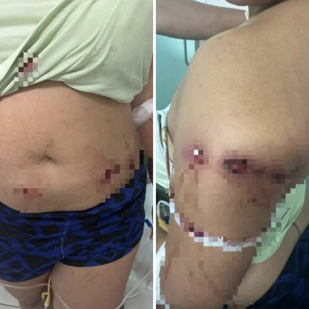 Desconocido hiere de varios disparos a mujer en centro de bebidas de Dajabón