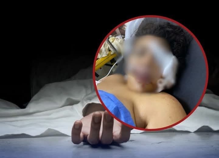 Muere Colombiana herida de bala en la cabeza por su pareja en Haina