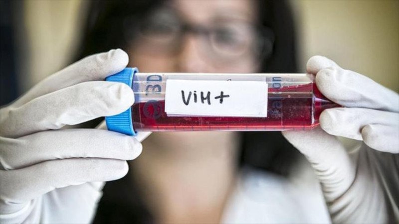 Alrededor de 4,000 casos positivos al VIH son reportados por año en el país