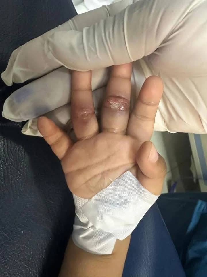 Muere niño de dos años en Los Alcarrizos bajo el cuidado de su madrastra