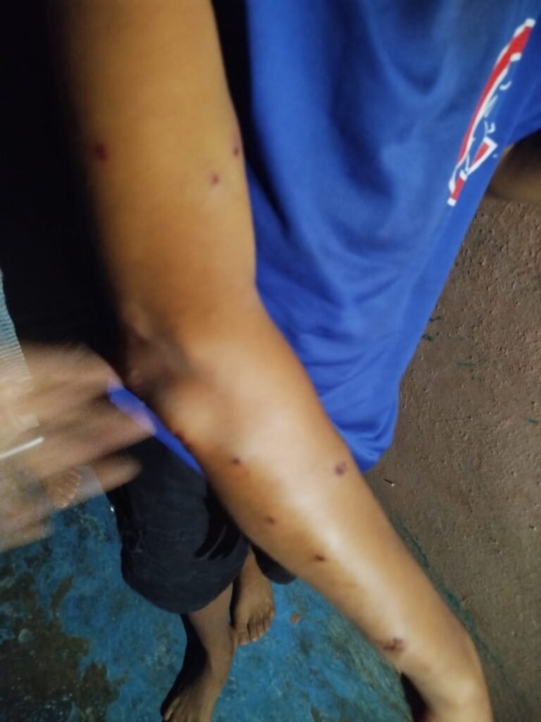 Policía hiere niño con disparo durante protestas en Independencia