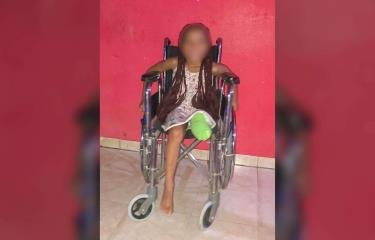 Reclaman justicia para niña embestida por motorista en Bayona
