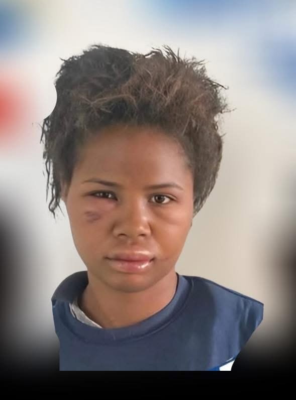 “Me apuñaló una y otra vez”: joven relata secuestro y brutal agresión de su expareja