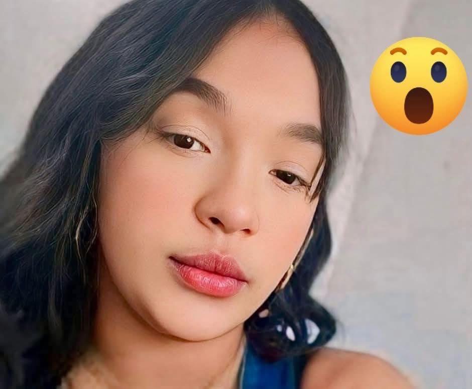 Mujer recibe más de 50 puntos en el rostro tras brutal pelea en Jarabacoa