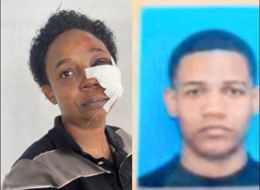 Policía activa la búsqueda de hombre acusado de agredir brutalmente a su madre en San Francisco de Macorís