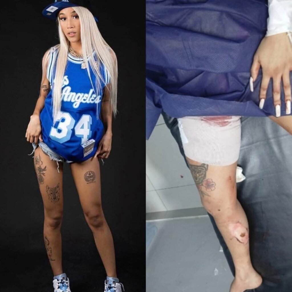 DICRIM investiga circunstancias donde La Demente recibió disparo en una pierna en Herrera