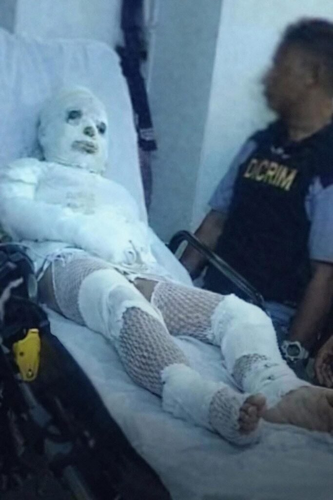 Hombre prende fuego a su propio hermano tras presunta discusión en Arroyo Hondo Abajo, Santiago