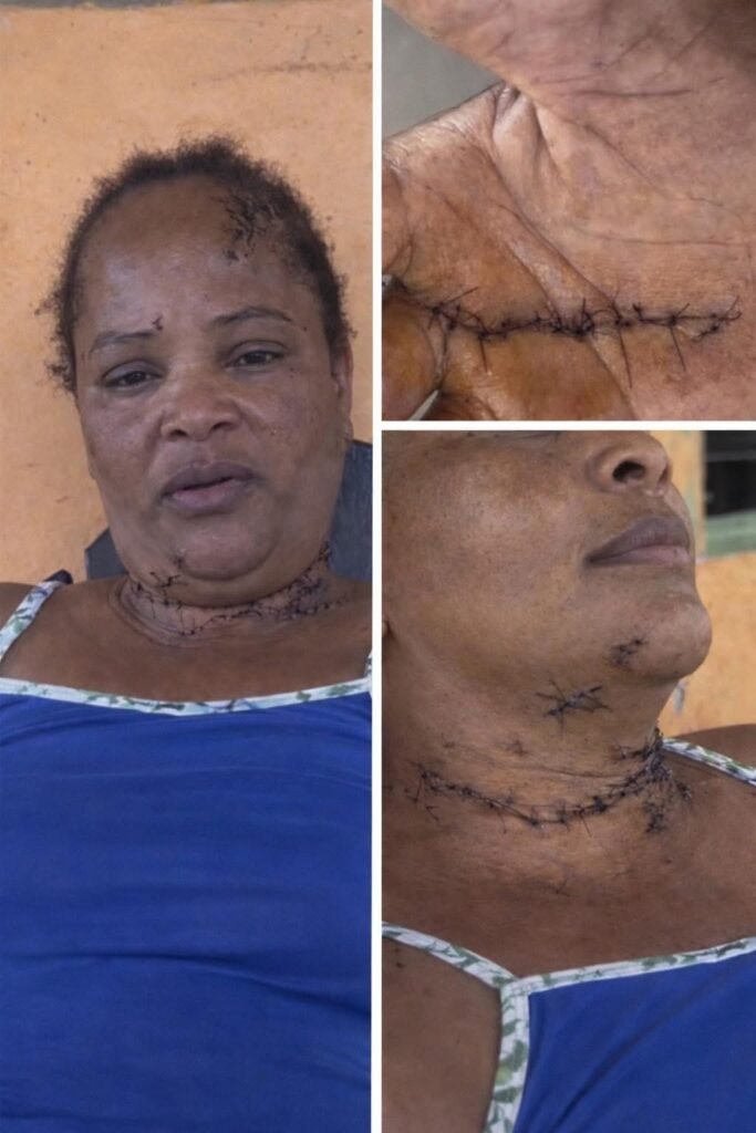 Mujer sobrevive a brutal ataque de su expareja en Sabana Yegua; agresor permanece prófugo