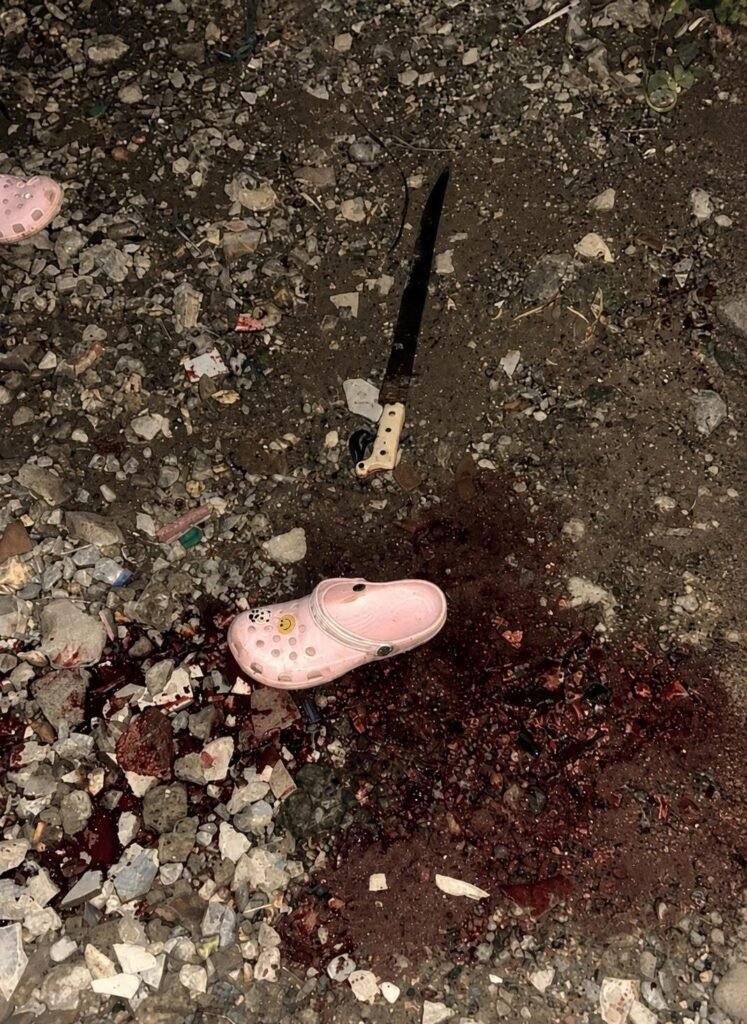 Mujer muere desangrada tras herida de arma blanca en Nagua; Policía investiga
